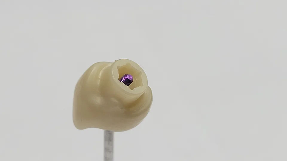 Zircone sur implant