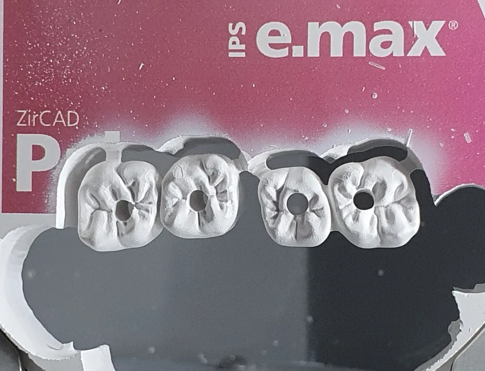 Zircone sur implant